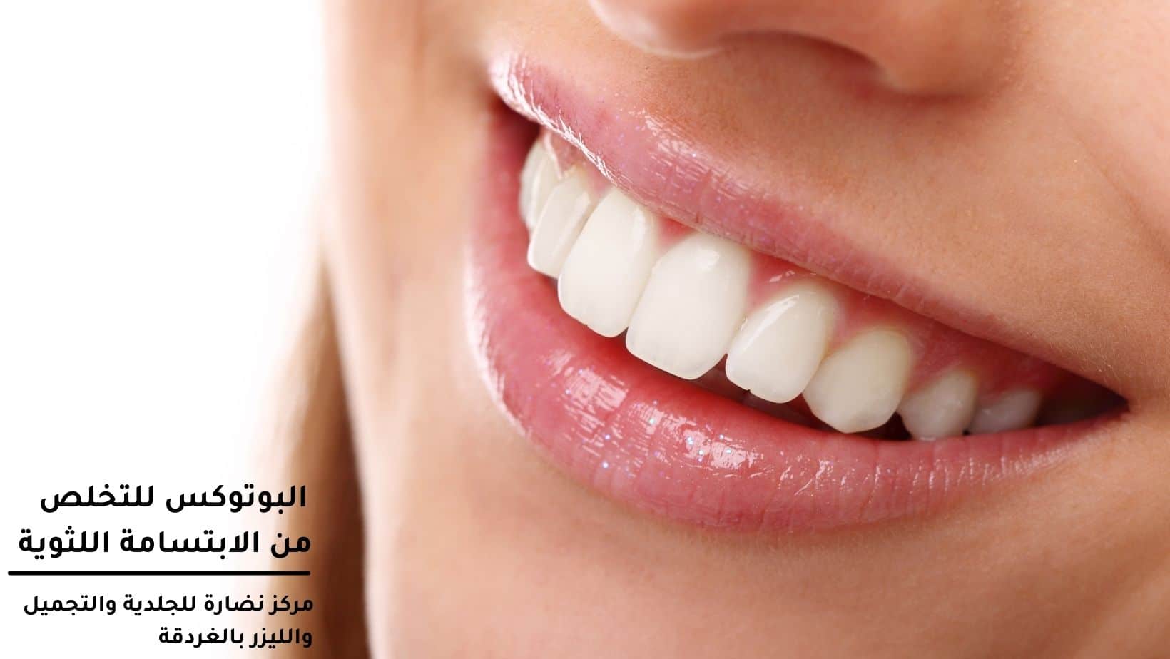 Botox to get rid of a gummy smile